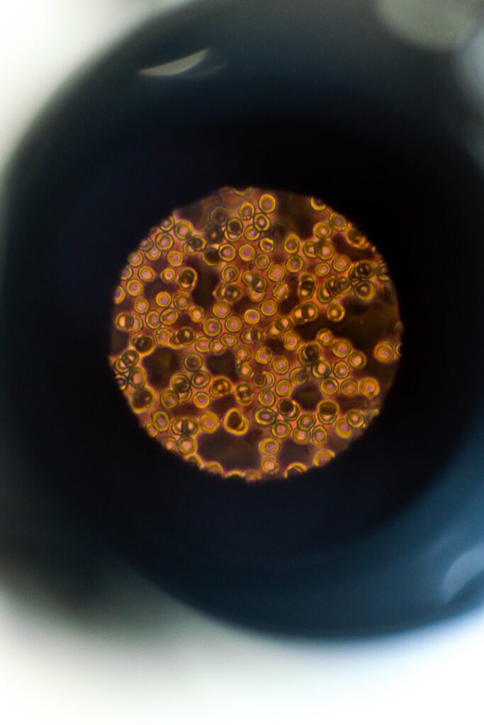 haematology